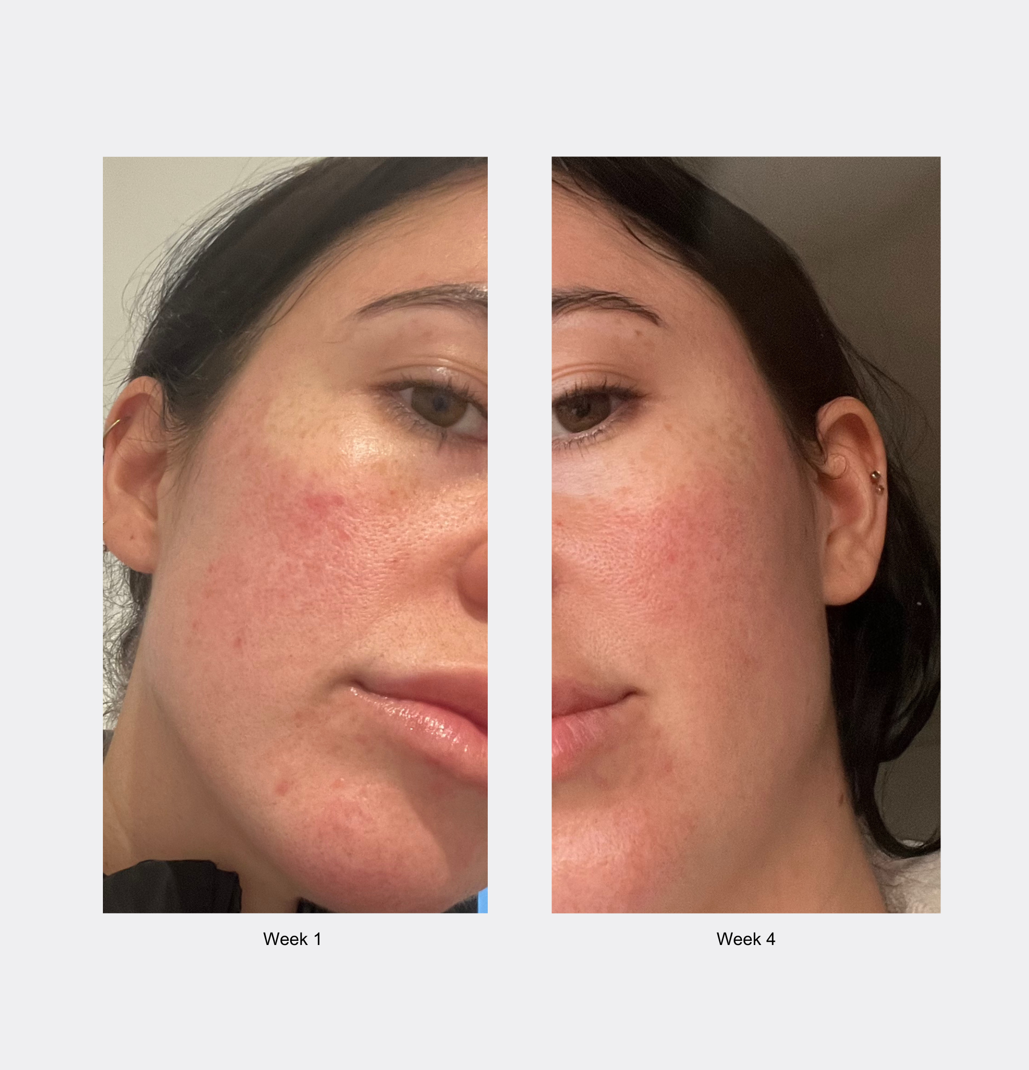 Before and after comparison of a woman's face with visible skin improvement over 4 weeks.