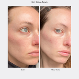 Before and after comparison of a woman's face with Skin Sponge Serum showing reduced redness.