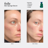 Skin Sponge Serum