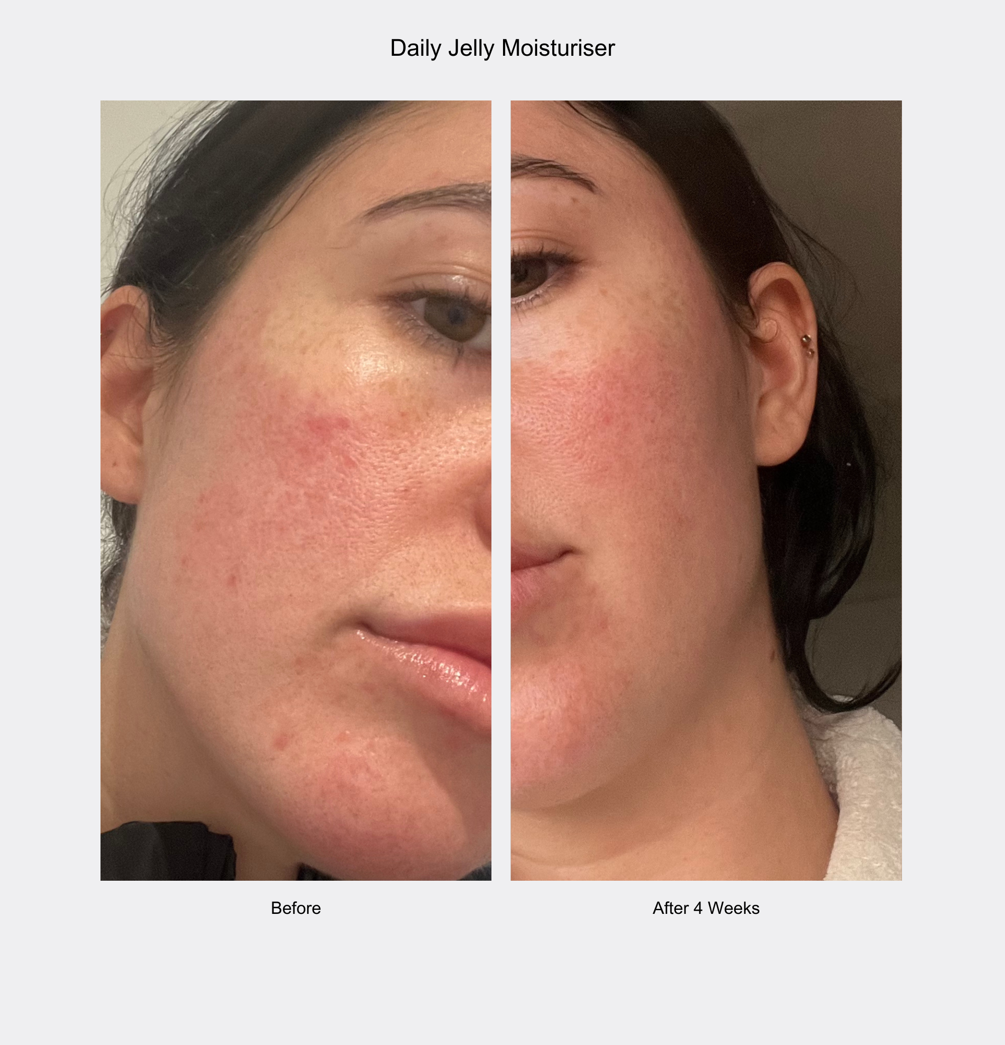 Before and after comparison of a woman's face using Daily Jelly Moisturizer.